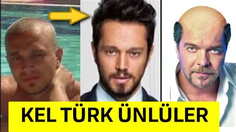 kel olan türk ünlüler